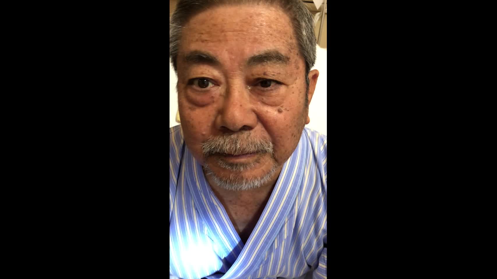 動画3　左ホルネル徴候