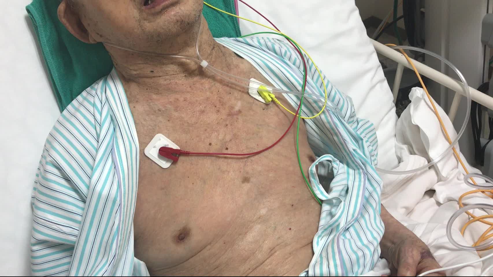 動画10-1　患者の呼吸状態