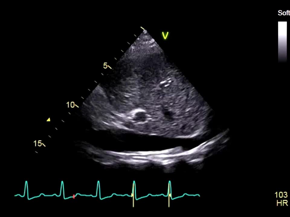 動画19-1　心エコー所見