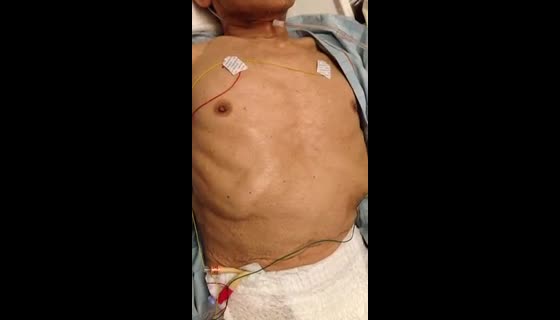 動画1-1　身体診察