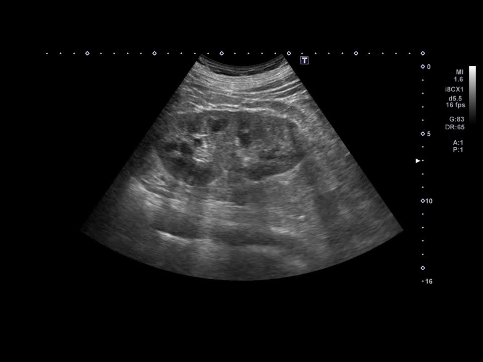 動画75-1　腹部超音波像（Bモード，カラードプラ）...