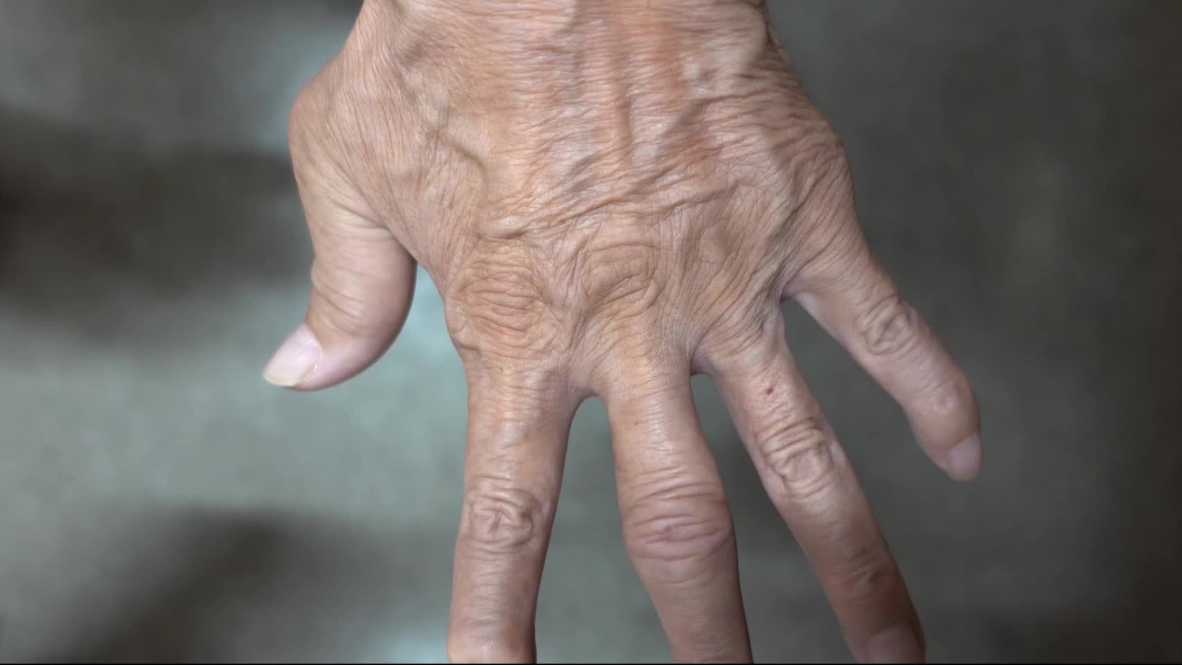 動画77-1　手の診察