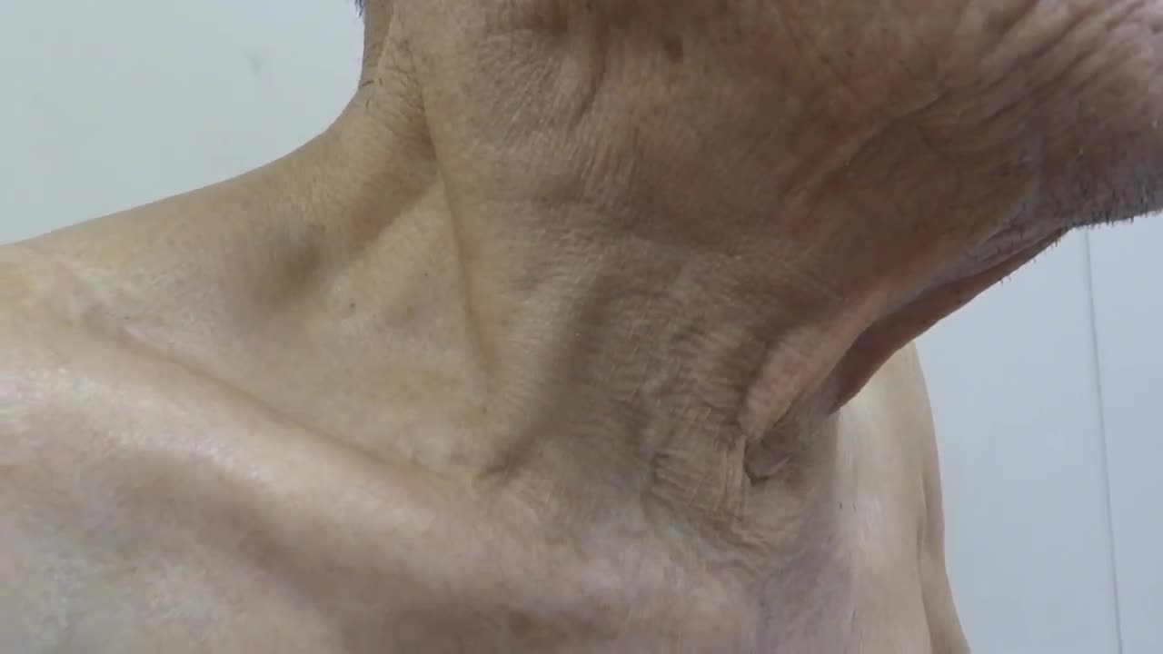 動画11-1　経静脈の動画