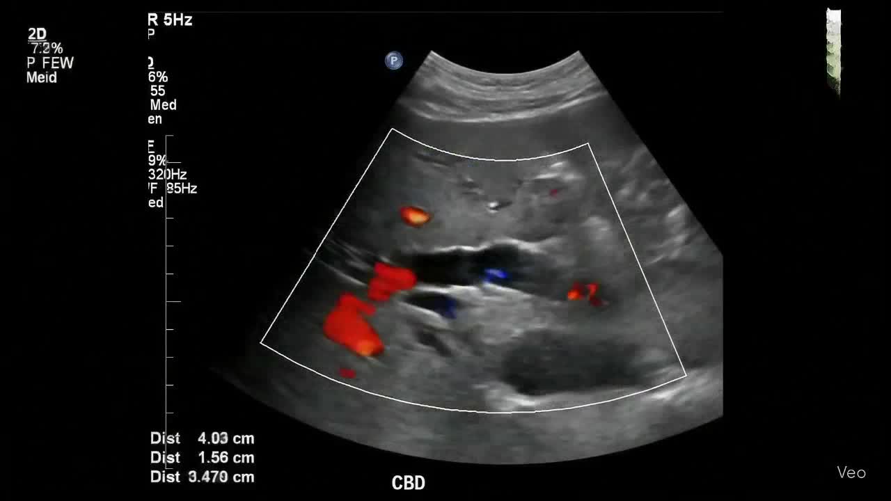動画39-1　腹部エコー