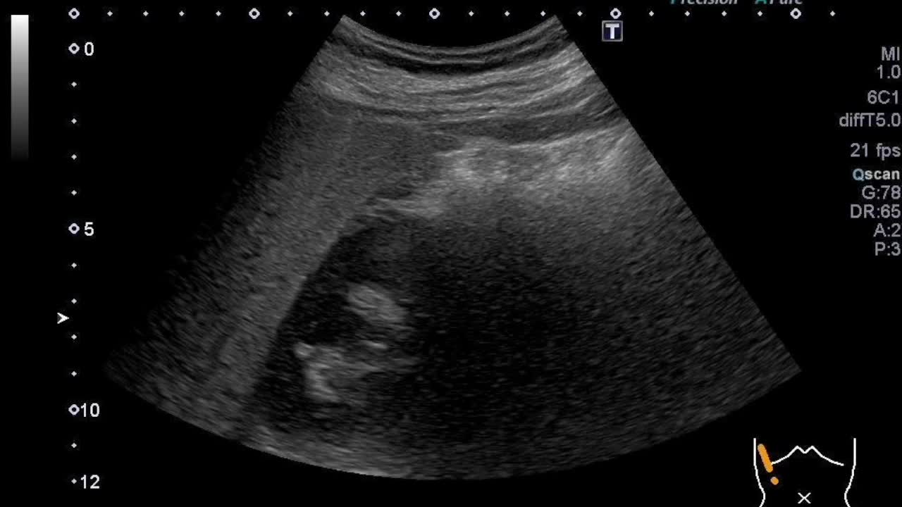 動画40-1　腹部エコー