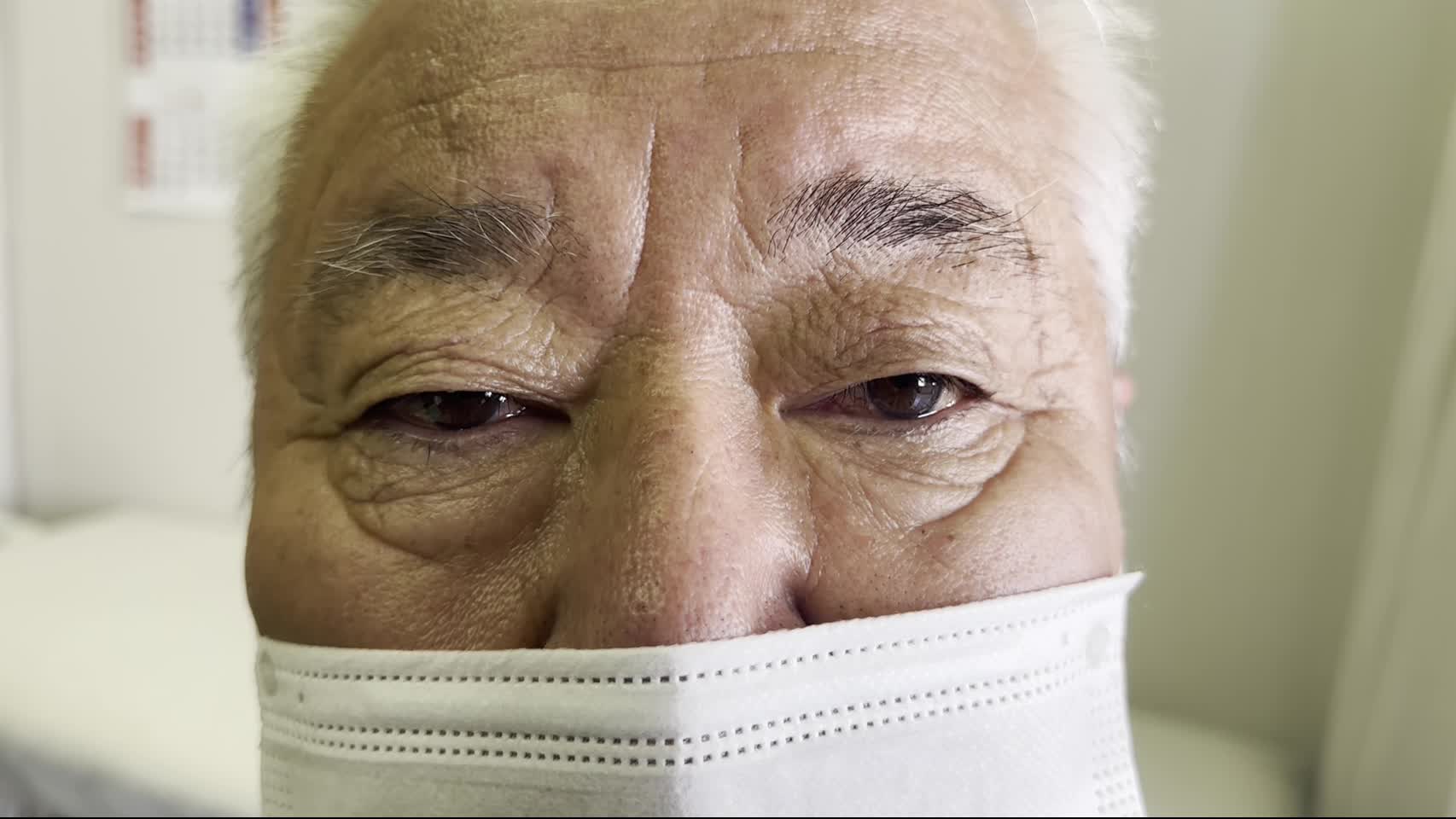 眼瞼の所見（治療前）