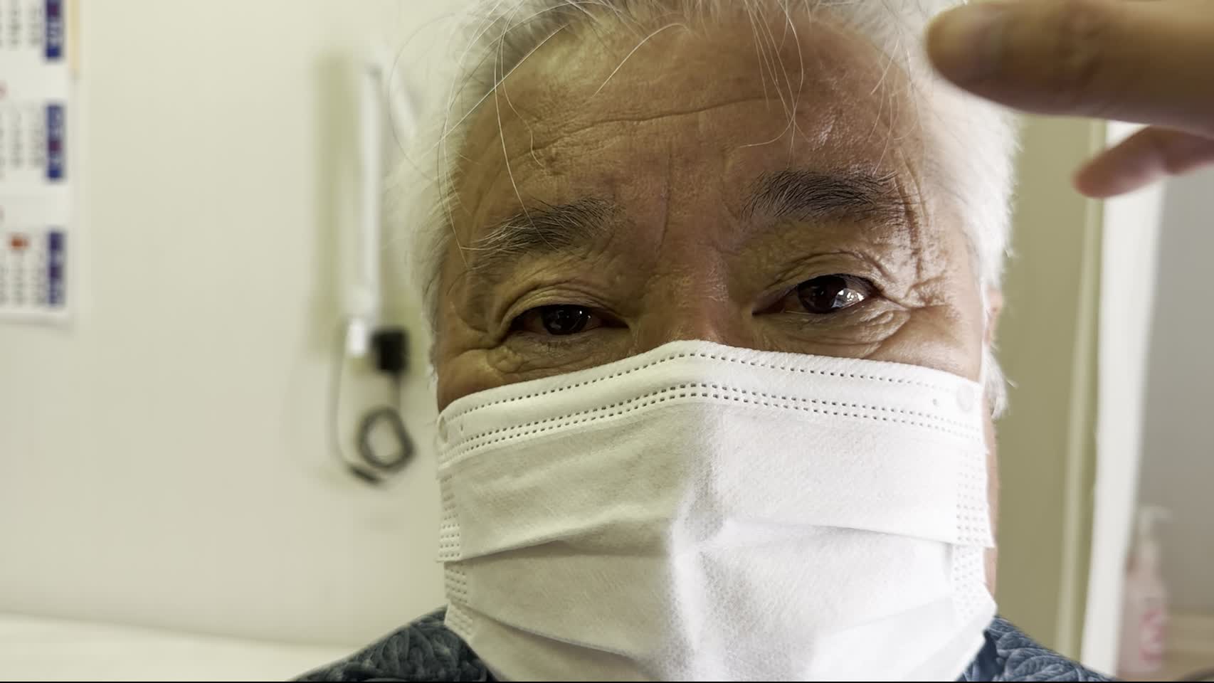 眼瞼の所見（治療後）