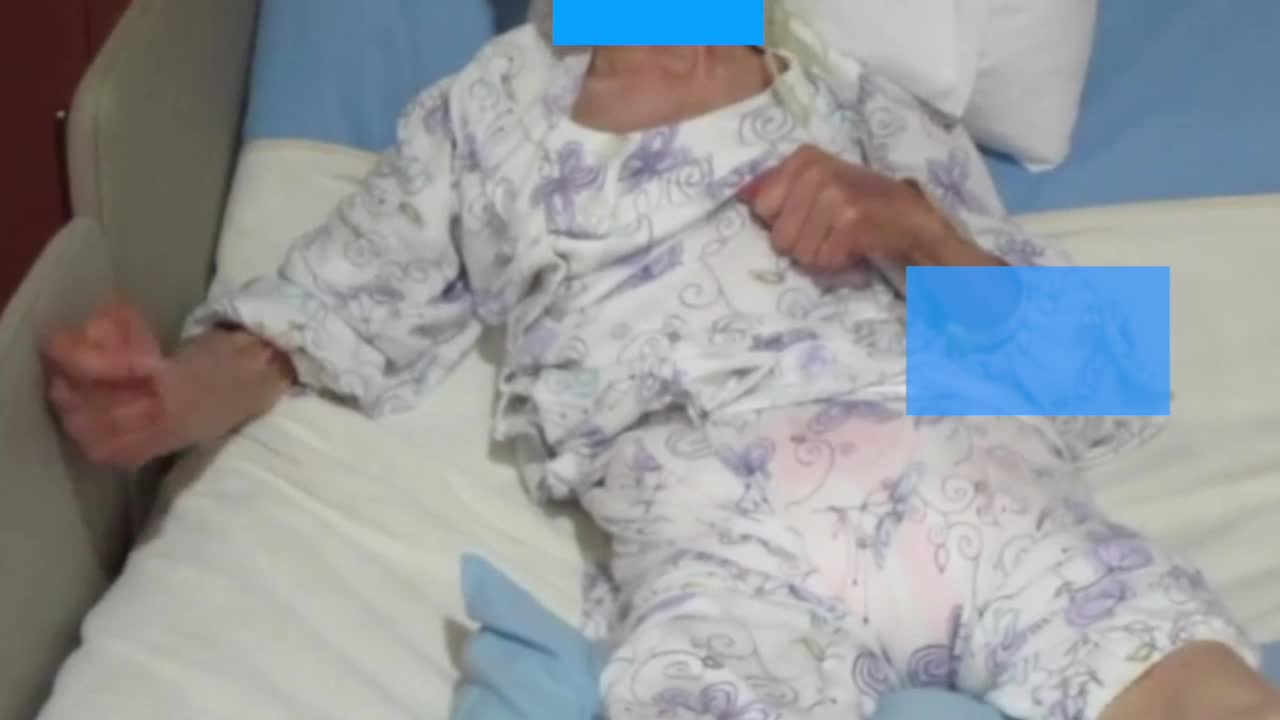 四肢の不随意運動