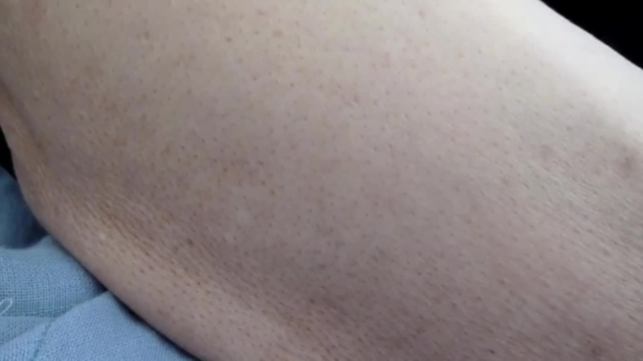 右上腕に観察された所見